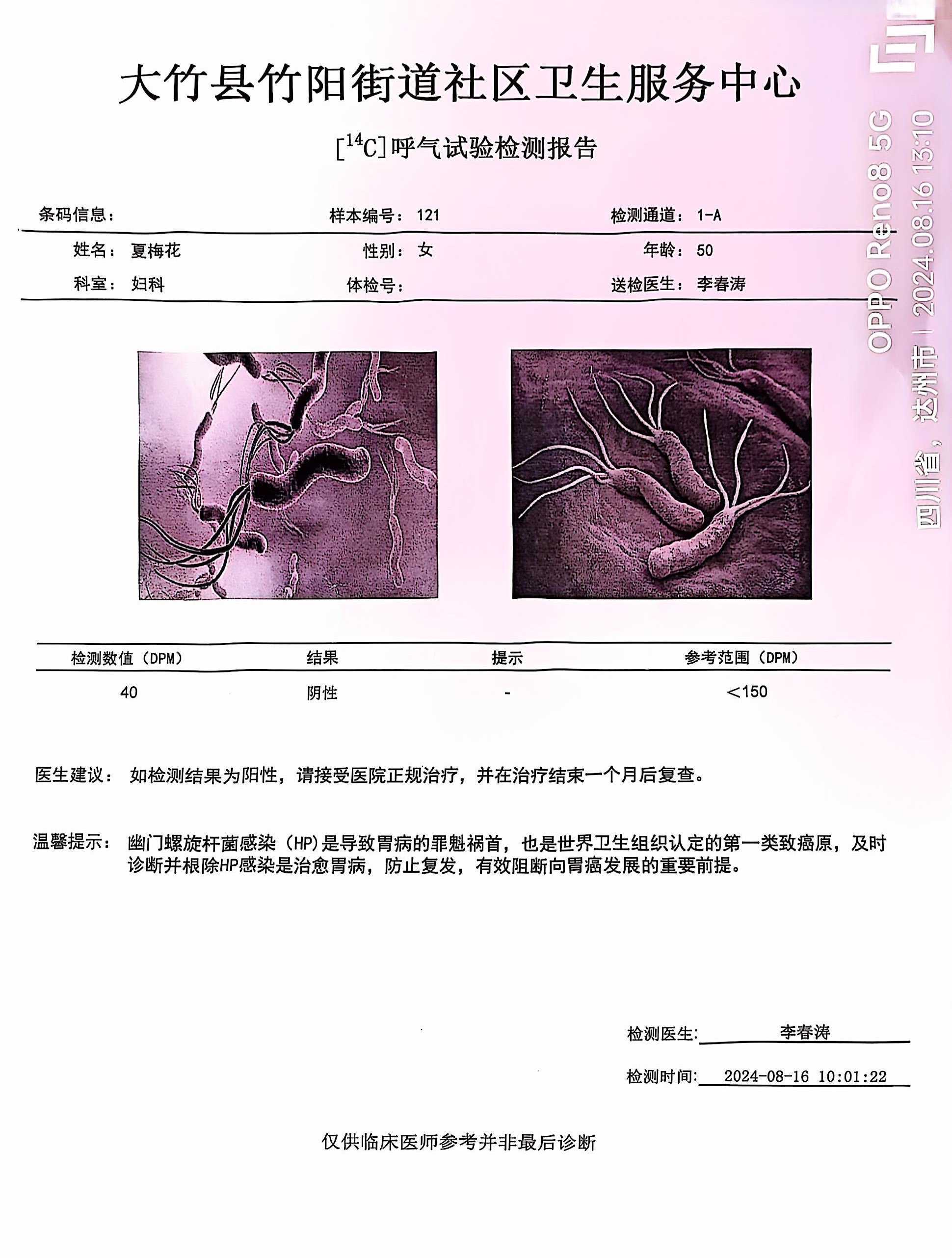 獲得其他